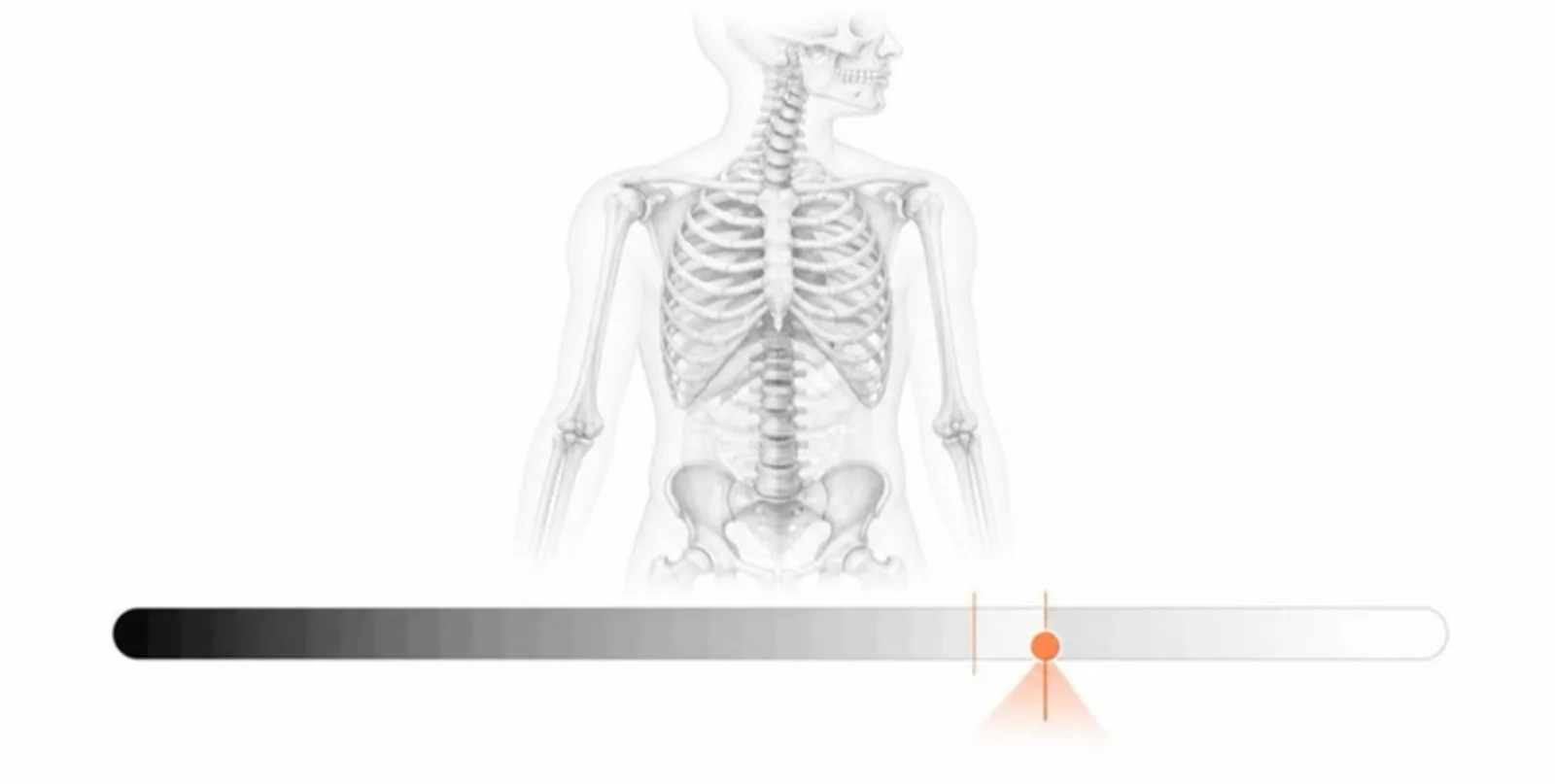 A skeleton above a CT density scale with a threshold marker