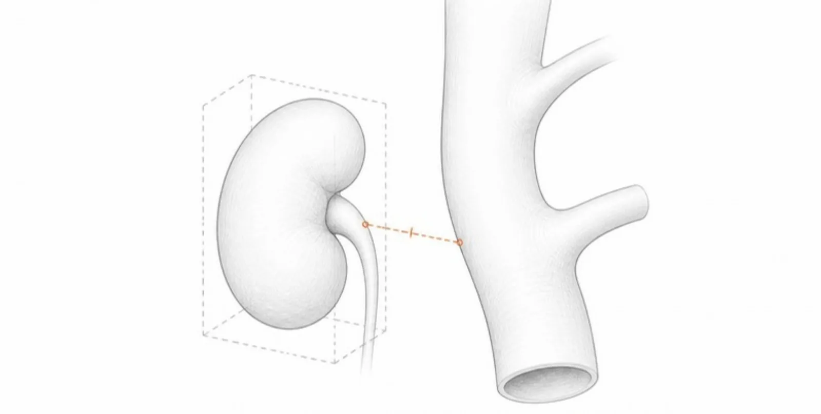 A kidney in a bounding box and the closest distance to a vessel