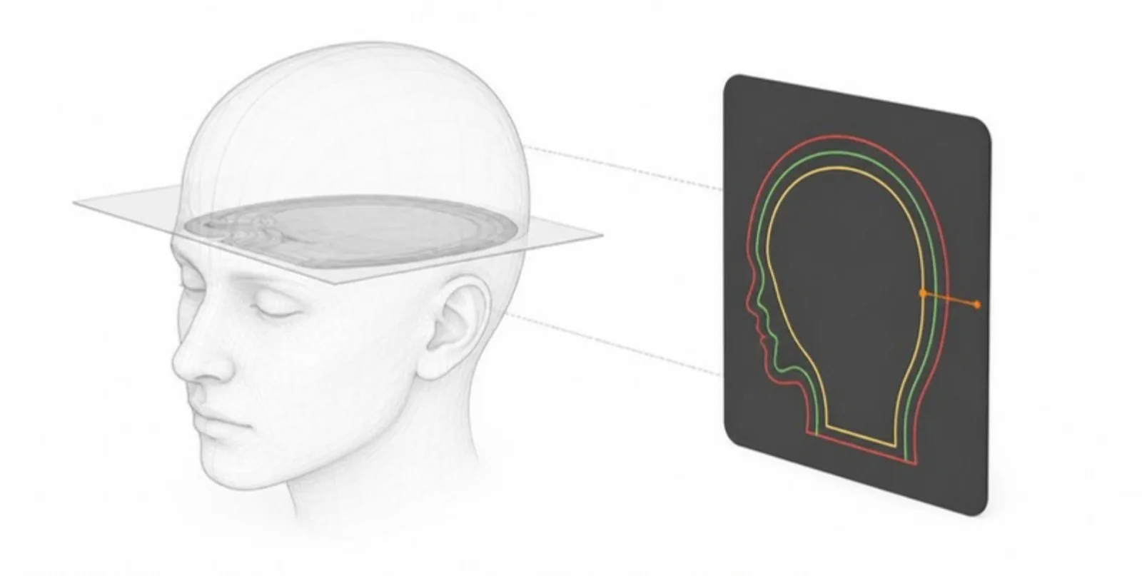 A head model cut by a plane next to its colour-coded 2D slice