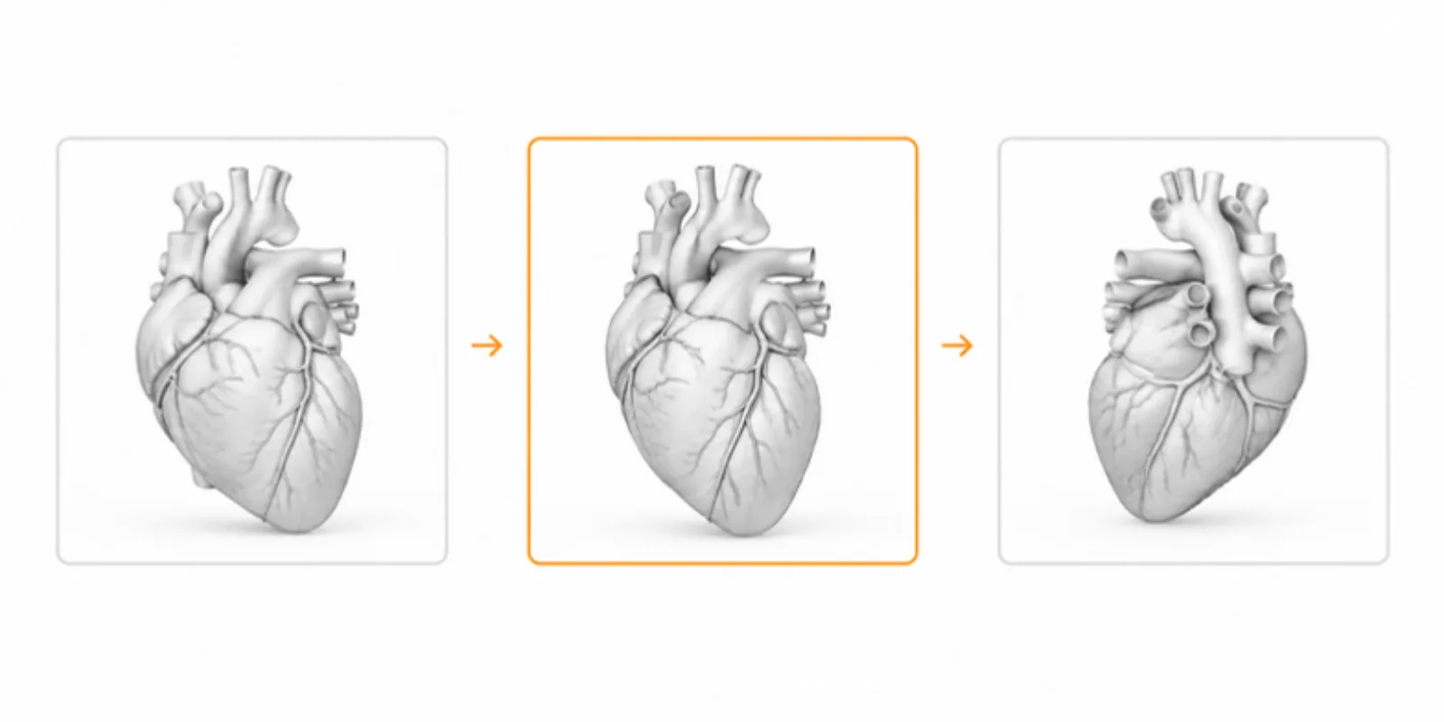 A row of three thumbnails showing one 3D heart model from three different angles, connected by arrows