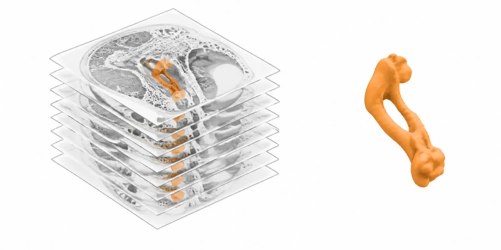 A micro-CT slice stack with one structure highlighted in orange and the same structure shown as a 3D surface
